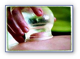 Cupping